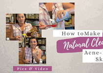 How to Make a Natural Cleanser for Acne Prone Skin