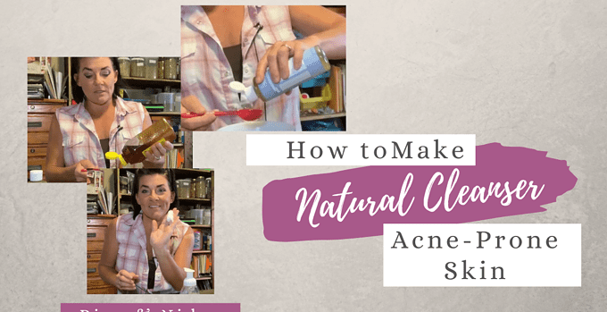 cleanser for acne prone skin