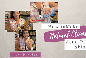 How to Make a Natural Cleanser for Acne Prone Skin