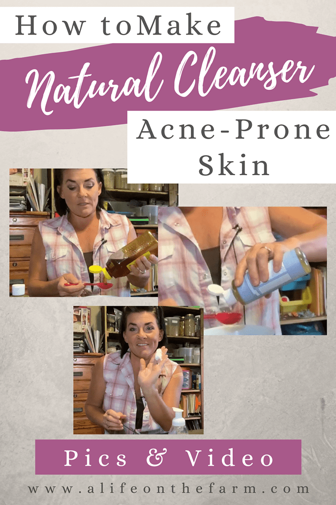 cleanser for acne prone skin